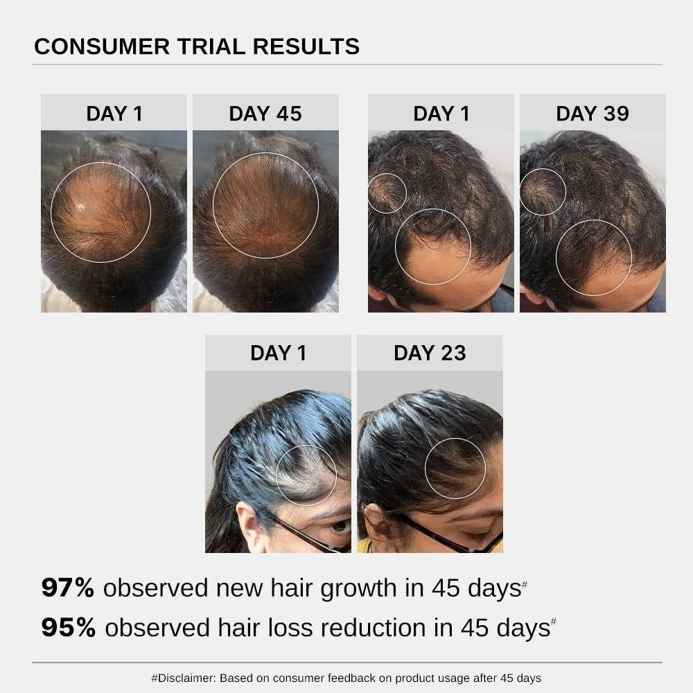 Nourishing Hair Growth Serum with Biotin & Rosemary