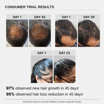Nourishing Hair Growth Serum with Biotin & Rosemary