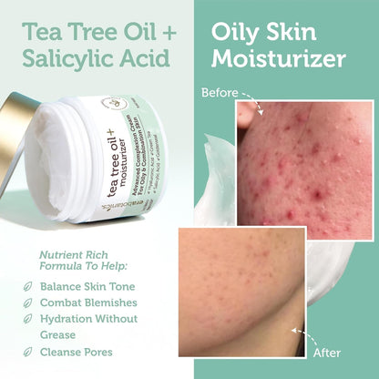 Natural Tea Tree Oil Face Cream - Acne Control Moisturizer