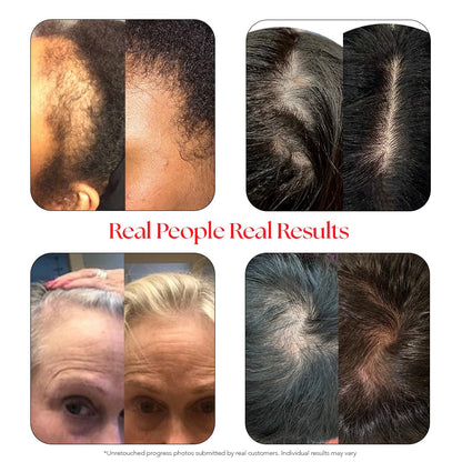 Nourishing Hair Growth Serum with Niacinamide and Aloe
