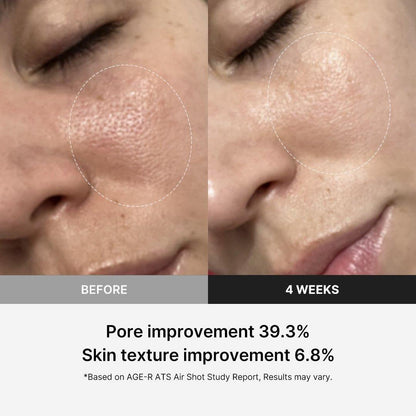 Advanced Skin Rejuvenation Air Shot Device