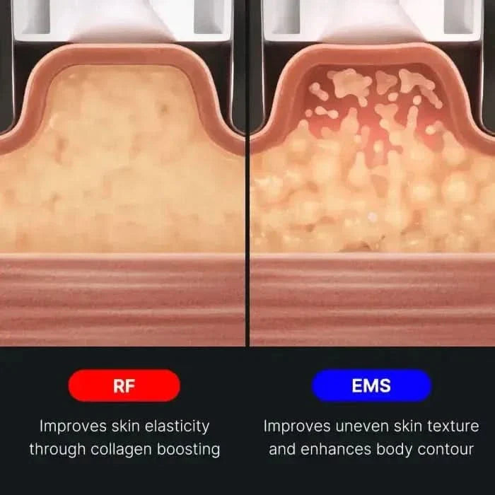Advanced Body Toning Device | High-Frequency Slimming Tool
