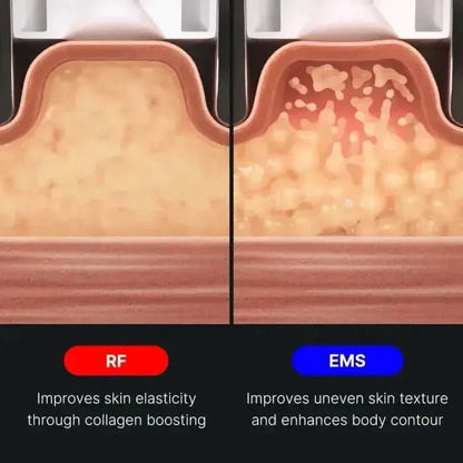 Advanced Body Toning Device | High-Frequency Slimming Tool