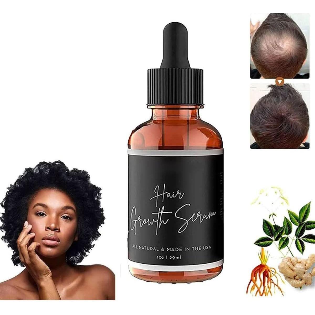 Natural Hair Growth Oil for Women - Thickening Serum 3 Pack - Mycosmeticslondon