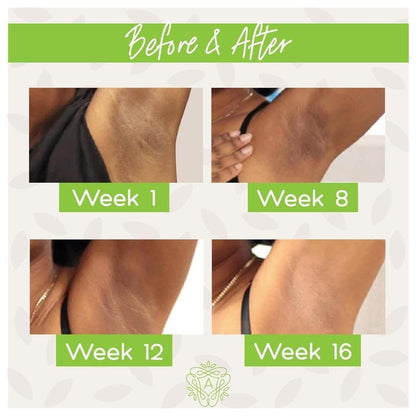 Gentle Skin Brightening Serum for Sensitive Areas