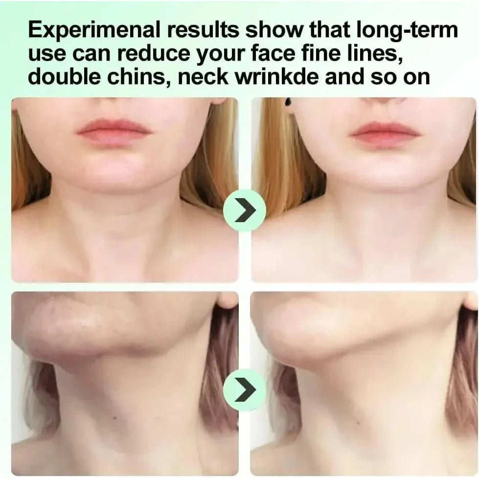 Wrinkle Reducing Facial Massage Roller