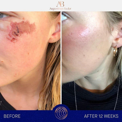 Rich Moisturizing Face Cream for Daily Hydration