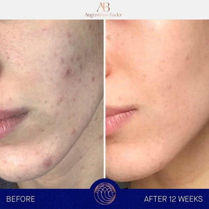 Rich Moisturizing Face Cream for Daily Hydration
