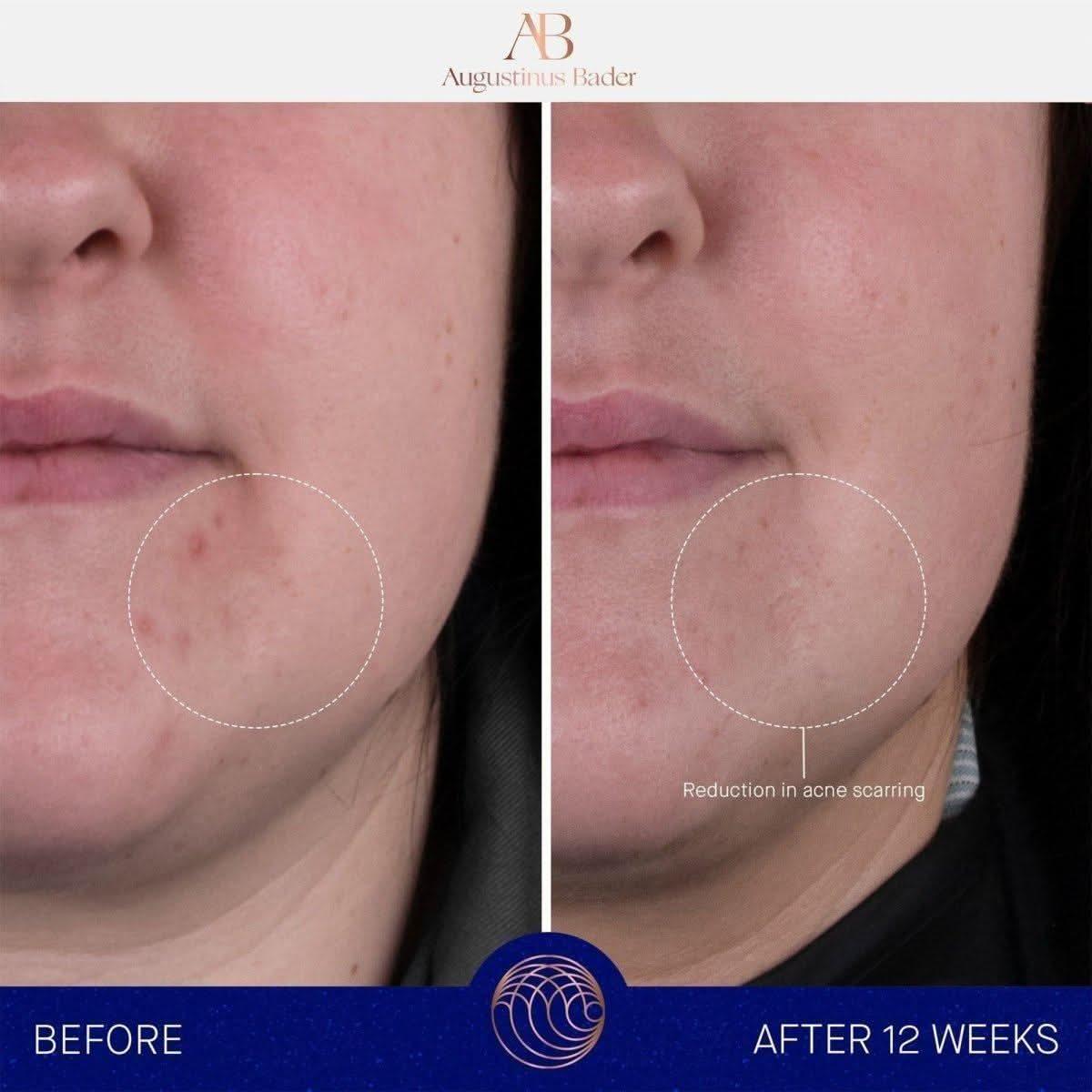 Luxurious Moisturizing Cream for Deep Hydration