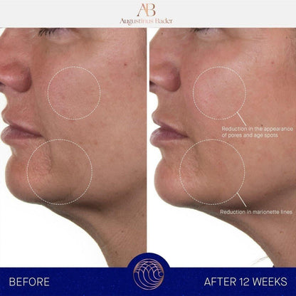 Luxurious Moisturizing Cream for Deep Hydration
