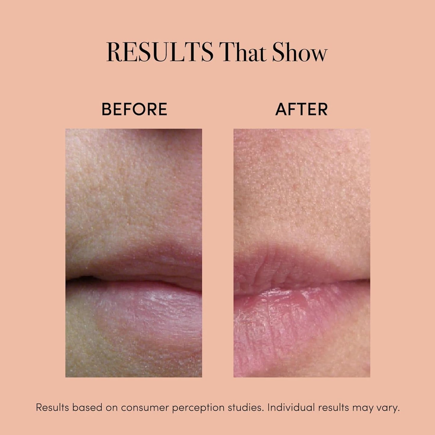 Red Light Lip Plumper Device