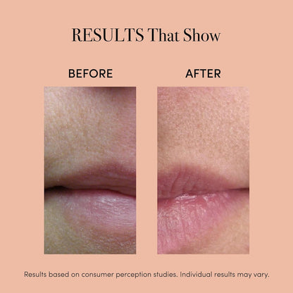 Red Light Lip Plumper Device