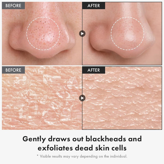 Natural Rice Face Exfoliator for Brighter Skin