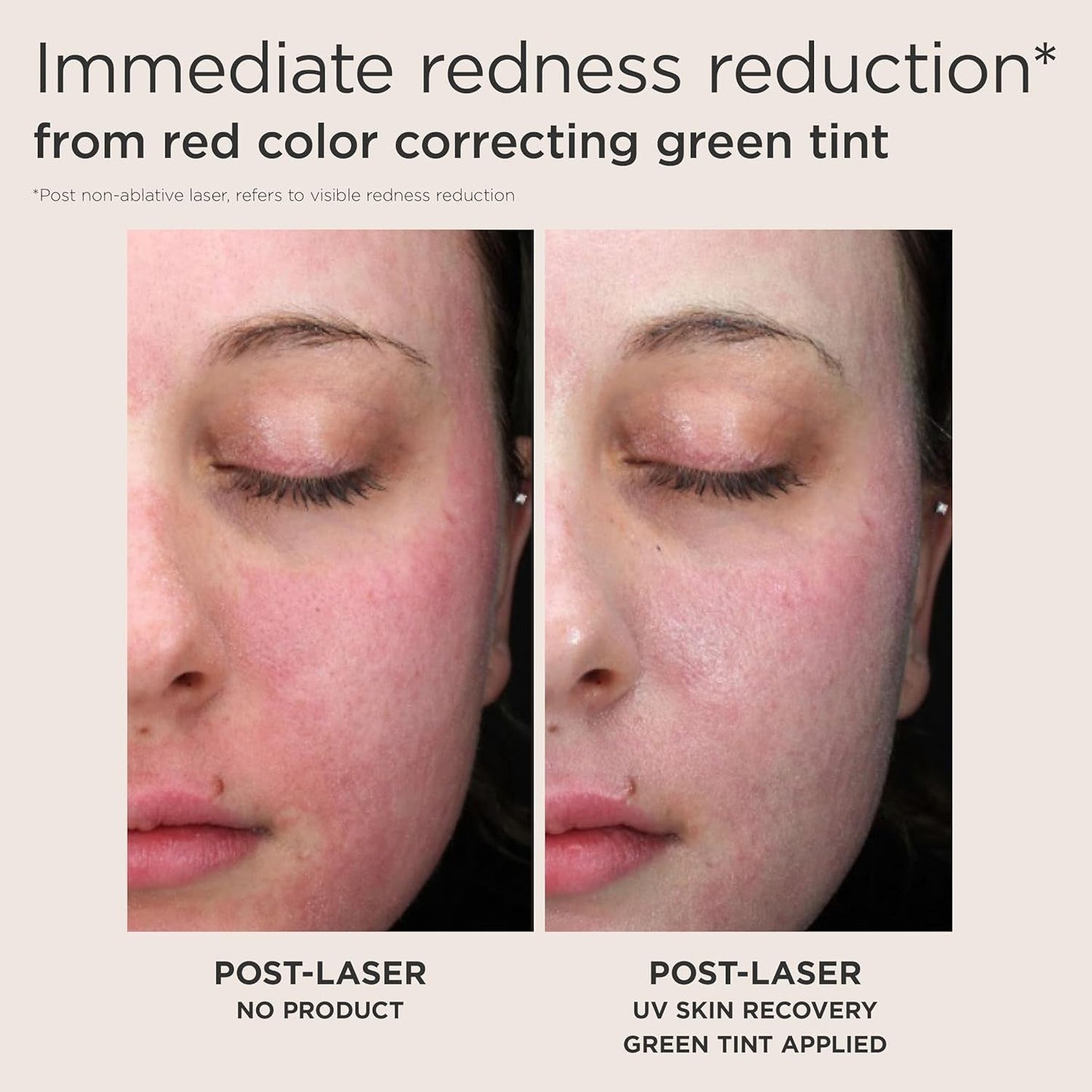 Soothing Redness Relief SPF 50 Serum