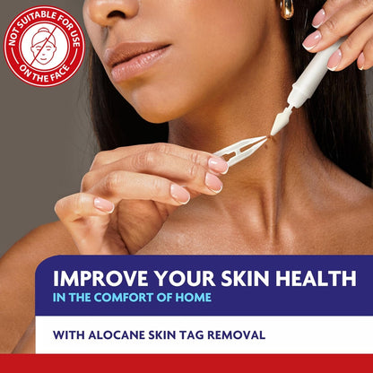 Easy At-Home Skin Tag Remover Spray