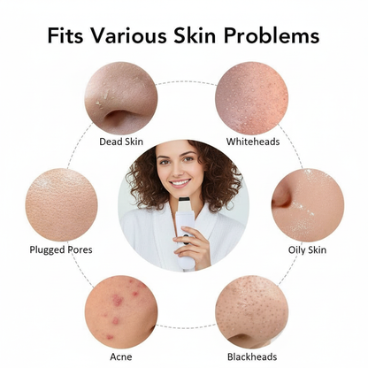 Ultrasonic Blackhead Remover 4-in-1