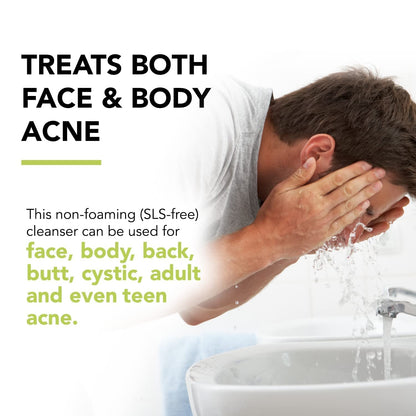 Effective Acne Treatment Face Wash - 10% Benzoyl Peroxide Cleanser