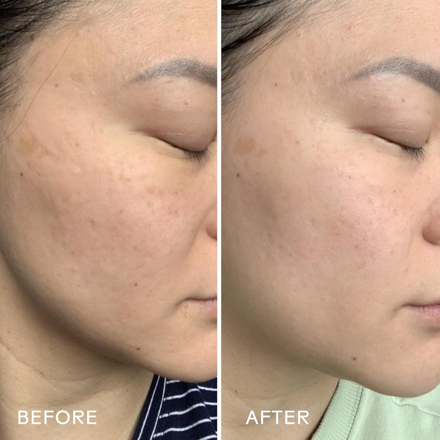 Natural Hydrating Face Serum with Plum and Hyaluronic Acid