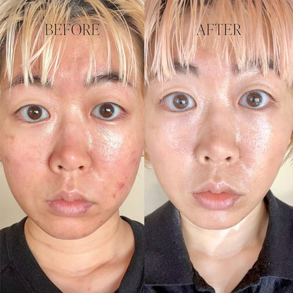 Natural Dark Spot Reducing Moisturizing Cream