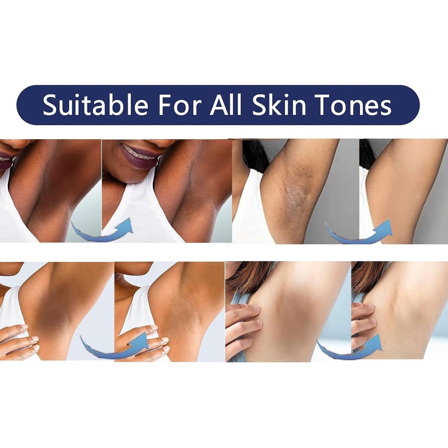Natural Intimate Skin Lightener Cream 30ml
