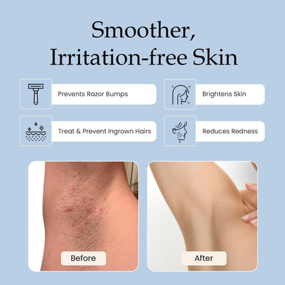 Soothing Ingrown Hair Relief Cream 90ml