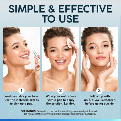 Glycolic Acid Skin Peel Pads - Exfoliate & Brighten