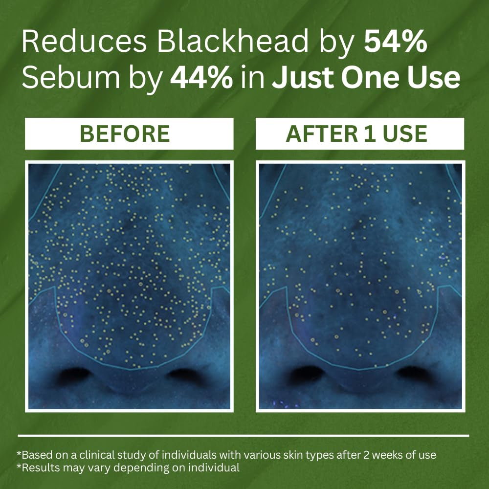 Purifying Blackhead Clay Face Mask