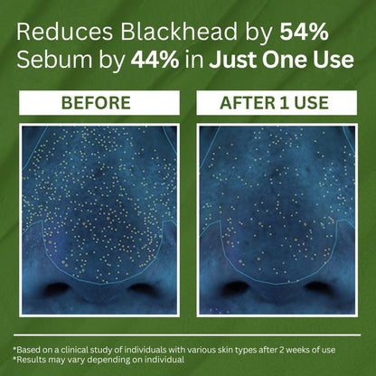 Purifying Blackhead Clay Face Mask