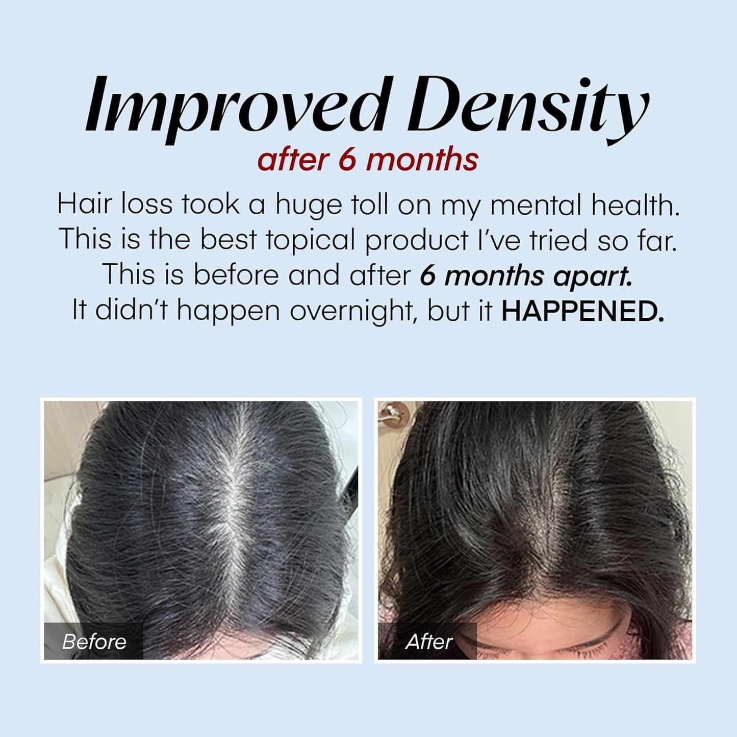 Natural Hair Growth Serum 20ml