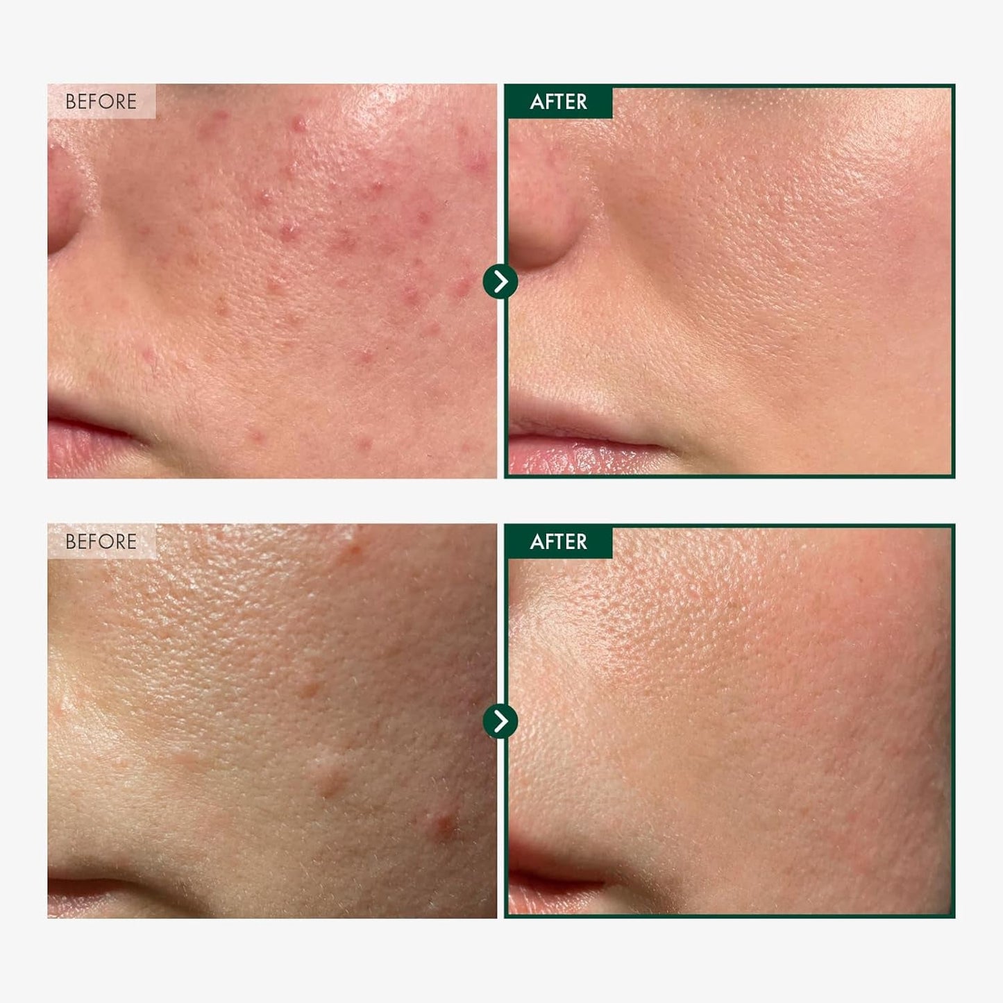 Natural Centella Calming Skin Ampoule 100ml