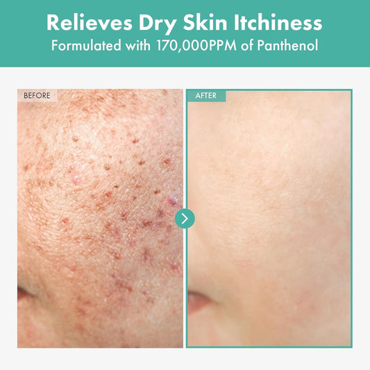 Moisturizing Dexpanthenol Face Cream 60ml