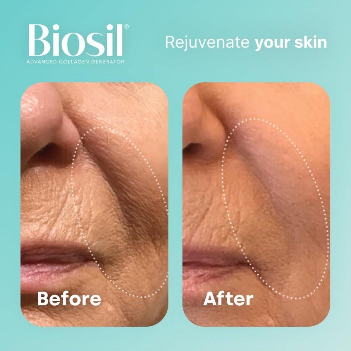 Natural Collagen Booster Supplement for Skin Hair Nails