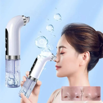 Pore Cleanser Tool - Gentle Exfoliating for Clear Skin - Mycosmeticslondon