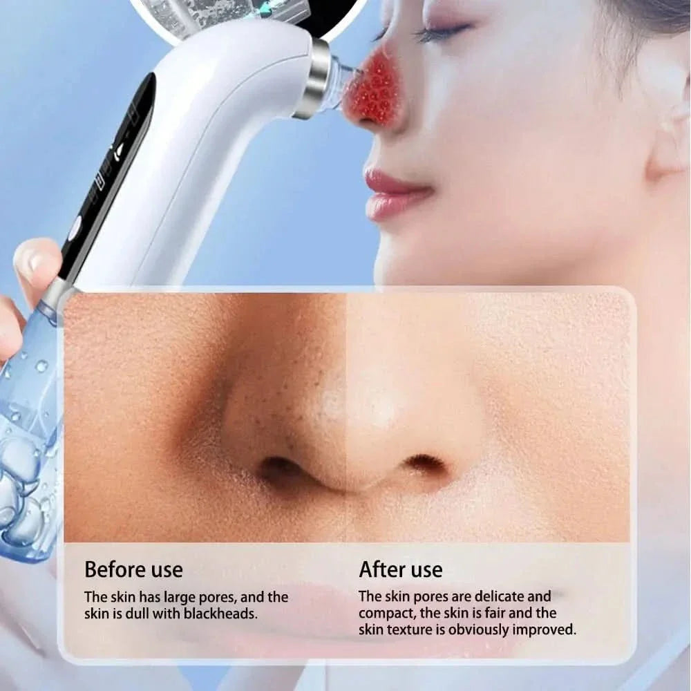 Pore Cleanser Tool - Gentle Exfoliating for Clear Skin
