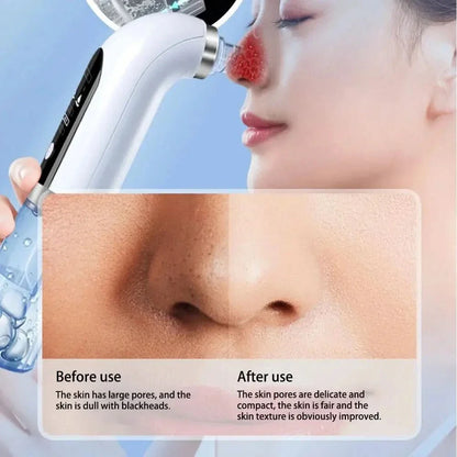 Pore Cleanser Tool - Gentle Exfoliating for Clear Skin