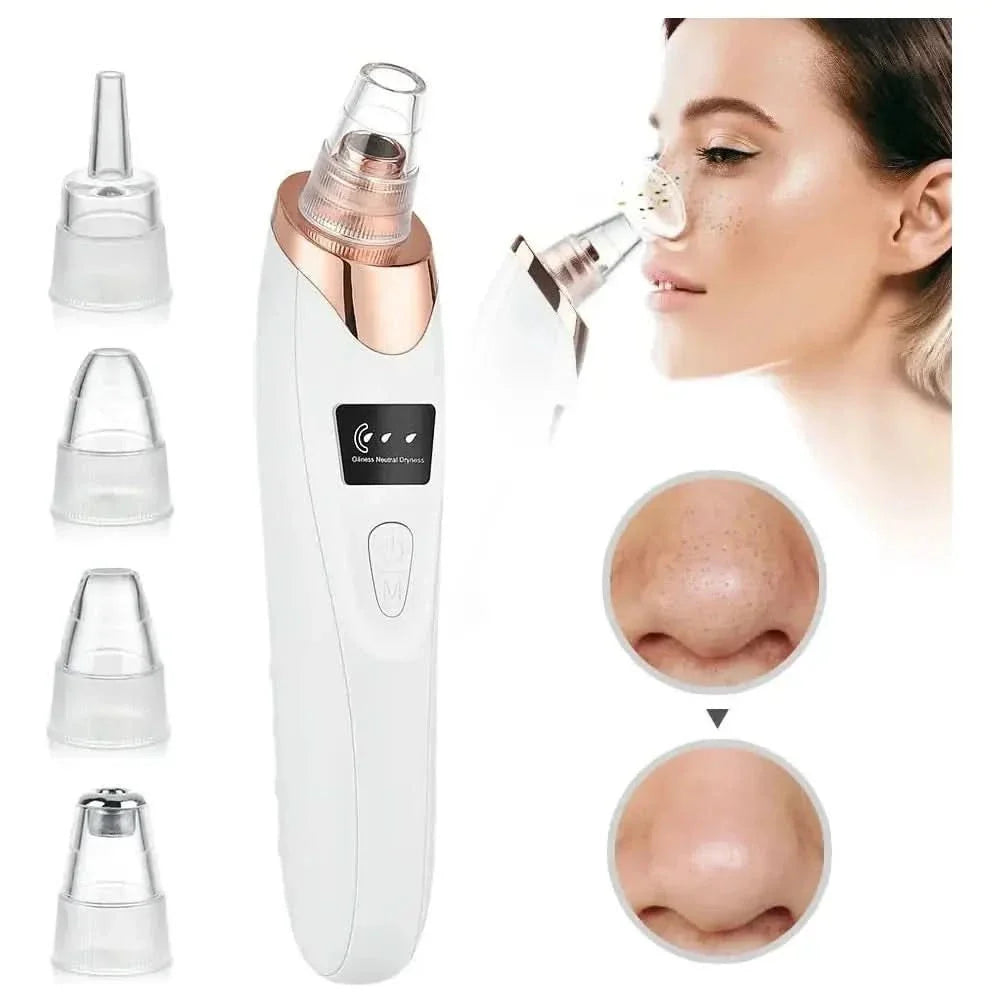 Pore Cleansing Facial Vacuum - Acne Spot Remover Tool