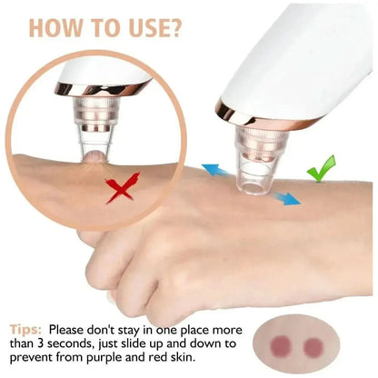 Pore Cleansing Facial Vacuum - Acne Spot Remover Tool
