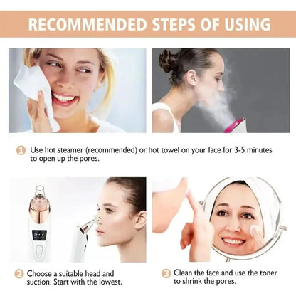 Pore Cleansing Facial Vacuum - Acne Spot Remover Tool