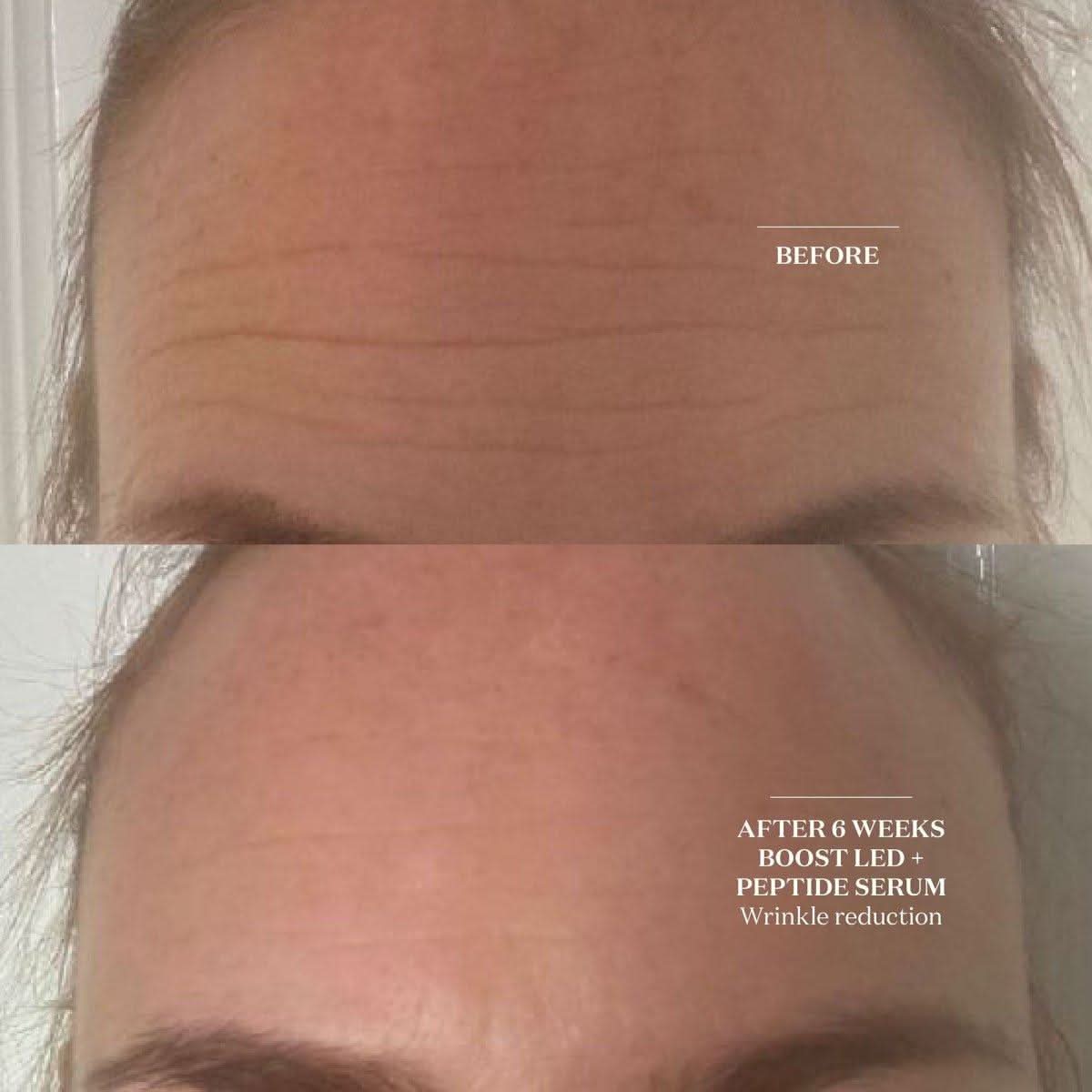 Brightening LED Face Mask | Advanced Skin Renewal
