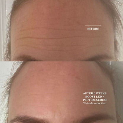 Brightening LED Face Mask | Advanced Skin Renewal