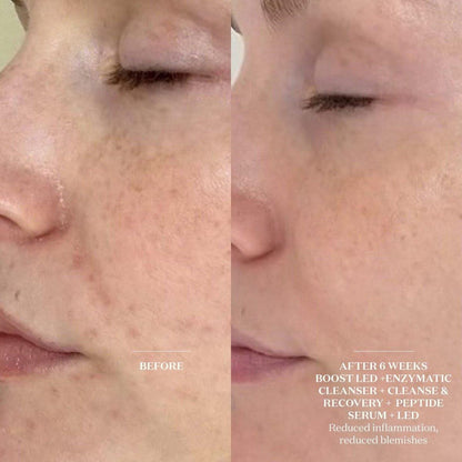 Brightening LED Face Mask | Advanced Skin Renewal