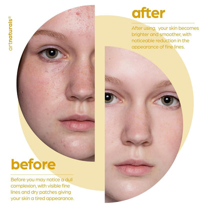 Glowing Skin Renewal Serum 30ml - Natural Exfoliating Moisturizer