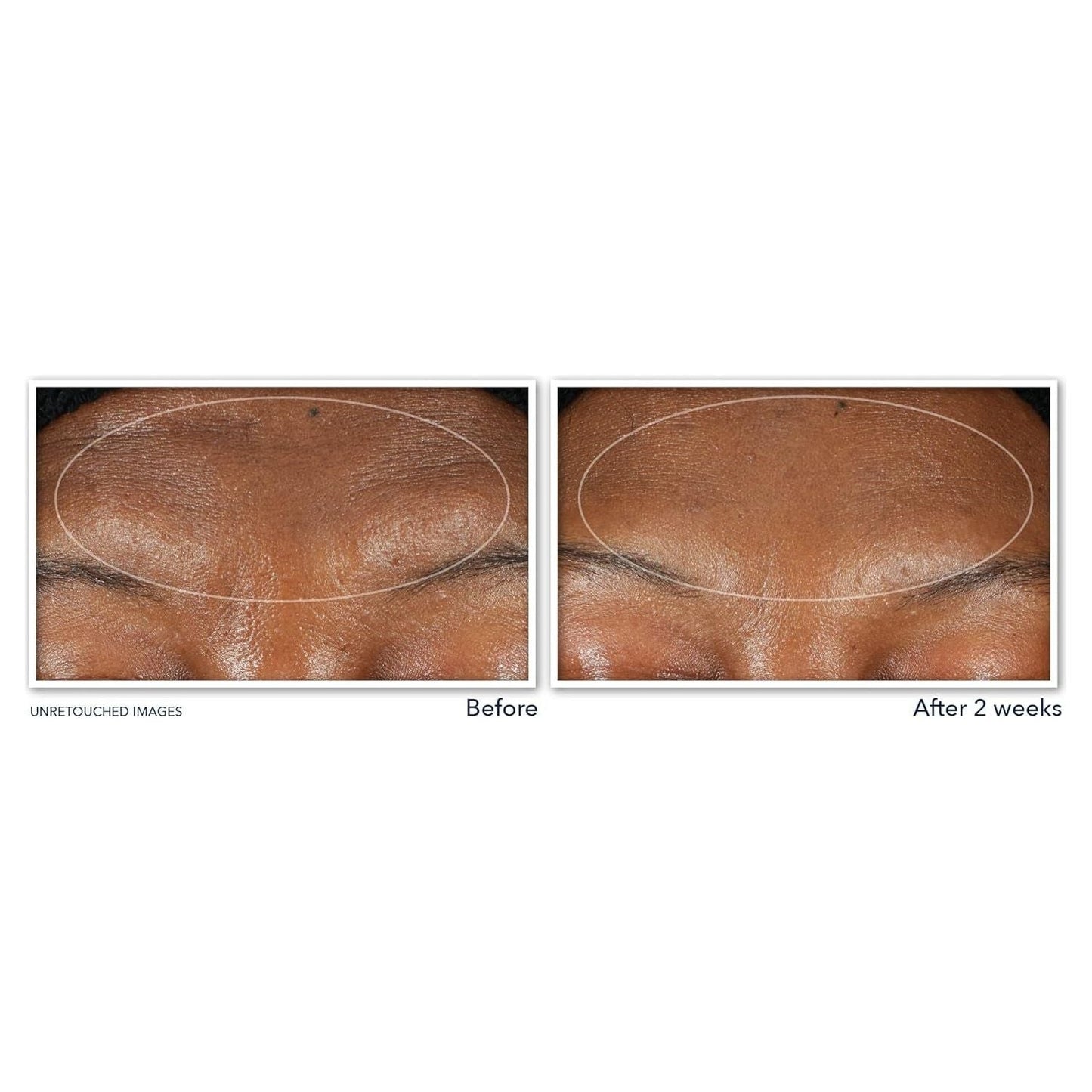 Anti Aging Retinol Face Serum Cleanser 177ml