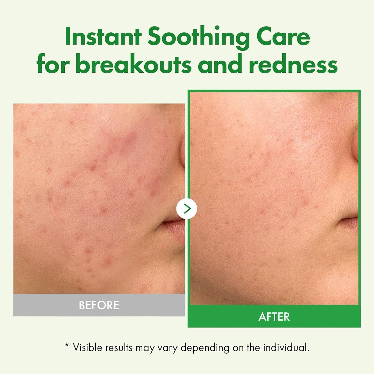 Natural Centella Moisturizing Cream 50ml - Fast Hydrating Relief