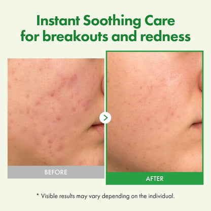 Natural Centella Moisturizing Cream 50ml - Fast Hydrating Relief