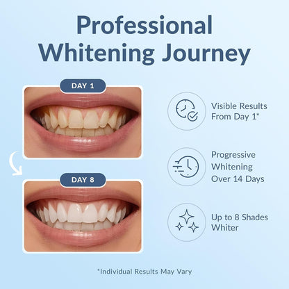 Professional At-Home Teeth Whitening Strips Kit