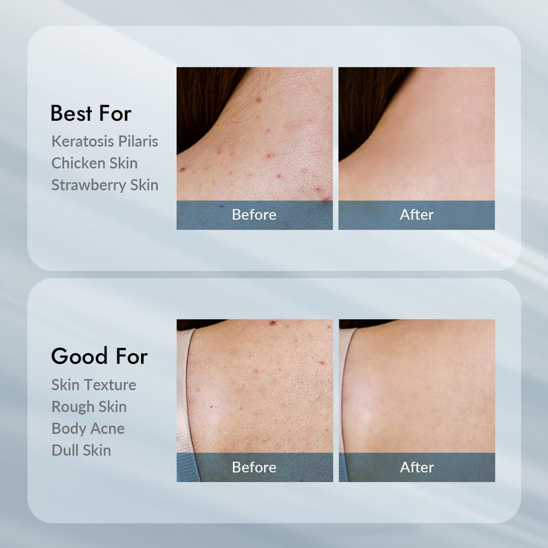 Gentle Exfoliating Moisturizing Body Lotion 300g