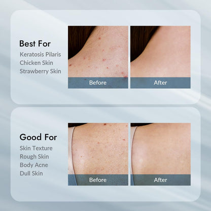 Gentle Exfoliating Moisturizing Body Lotion 300g