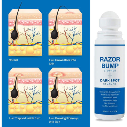 Gentle Razor Bump Treatment + Dark Spot Corrector