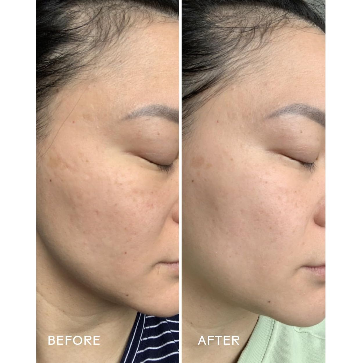 Nourishing Grape Stem Cell Moisturizing Face Cream 50g